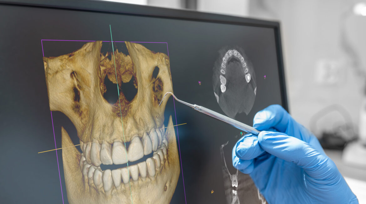 How a Routine Dental Visits can lead to early detection of abnormalities