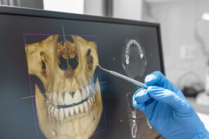 How a Routine Dental Visits can lead to early detection of abnormalities