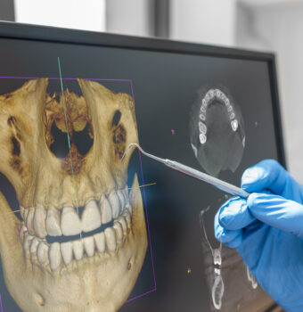 How a Routine Dental Visits can lead to early detection of abnormalities