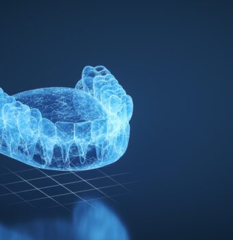 How digital dentistry has revolutionized the dental practice
