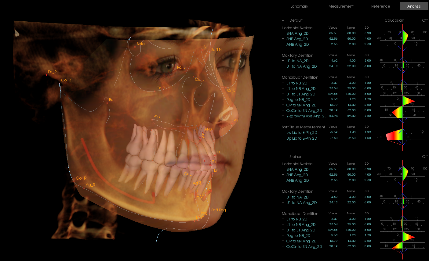 Anatomage_Invivo_3D_Analysis_15